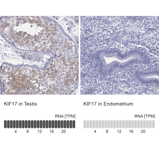 KIF17 Antibody in Immunohistochemistry (IHC)