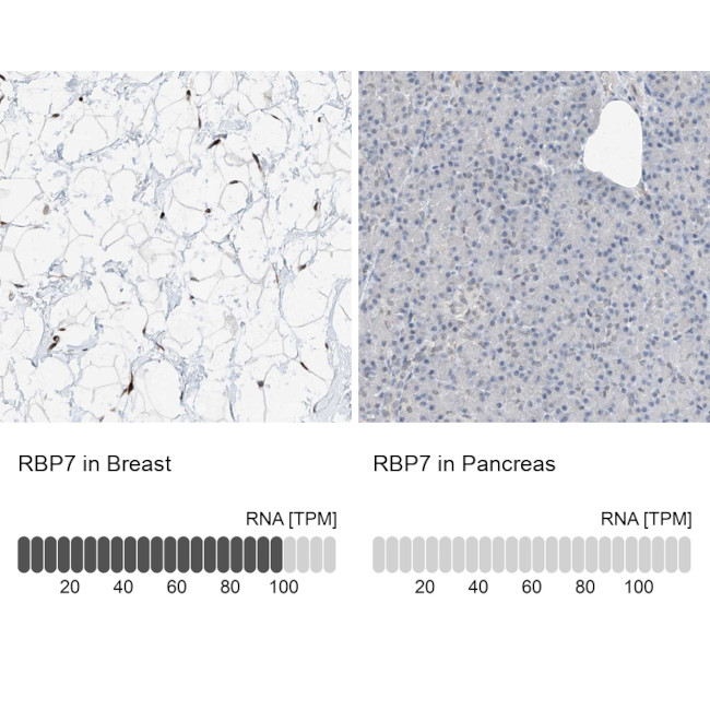 RBP7 Antibody in Immunohistochemistry (IHC)