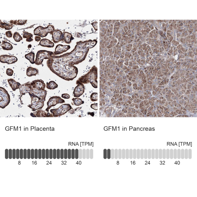 GFM1 Antibody in Immunohistochemistry (IHC)