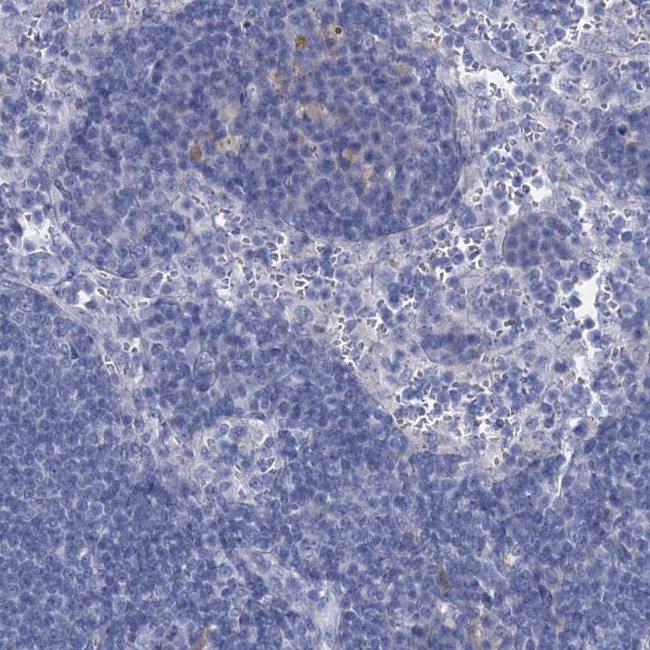 GSTM3 Antibody in Immunohistochemistry (IHC)