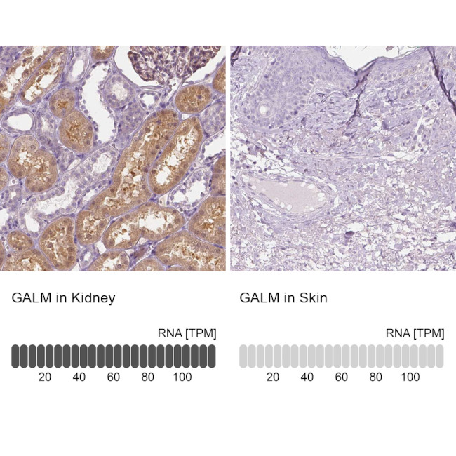 GALM Antibody in Immunohistochemistry (IHC)