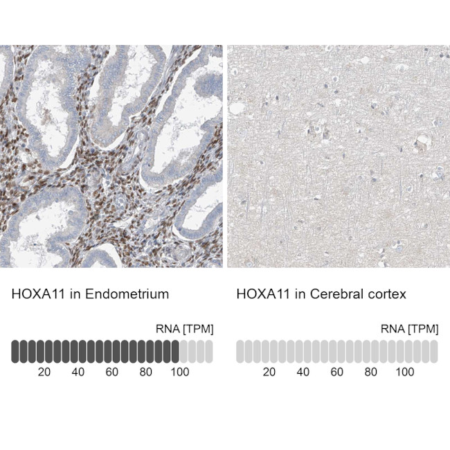 HOXA11 Antibody in Immunohistochemistry (IHC)