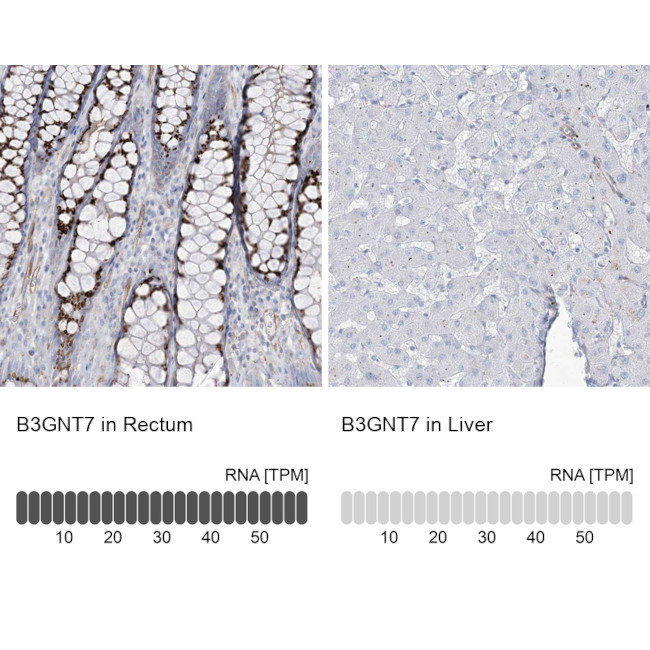 B3GNT7 Antibody in Immunohistochemistry (IHC)