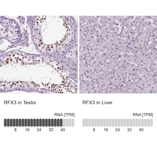 RFX3 Antibody in Immunohistochemistry (IHC)