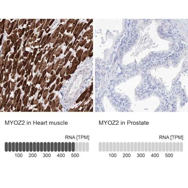 MYOZ2 Antibody in Immunohistochemistry (IHC)