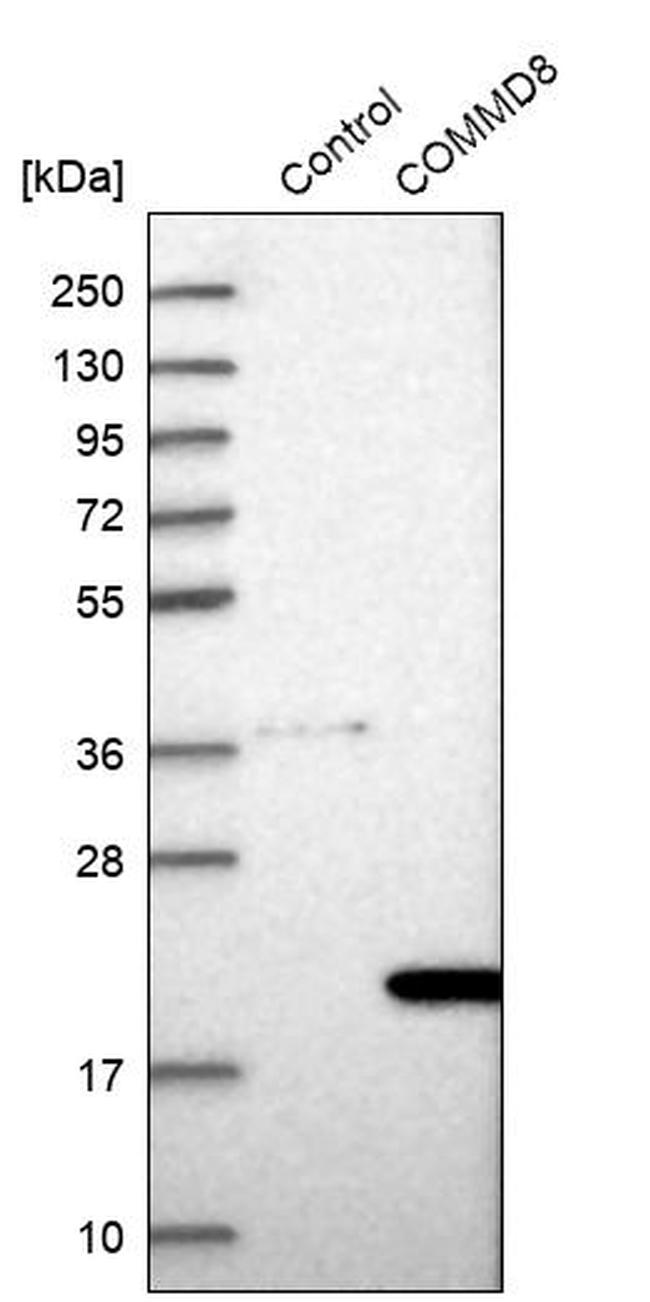 COMMD8 Antibody in Western Blot (WB)
