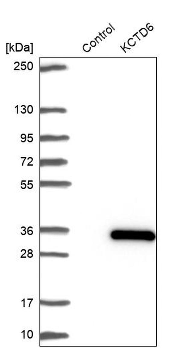KCTD6 Antibody in Western Blot (WB)
