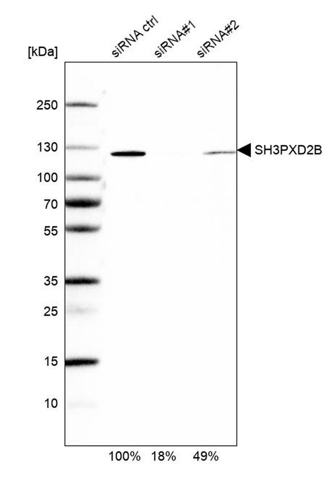 SH3PXD2B Antibody in Western Blot (WB)