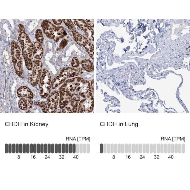 CHDH Antibody in Immunohistochemistry (IHC)