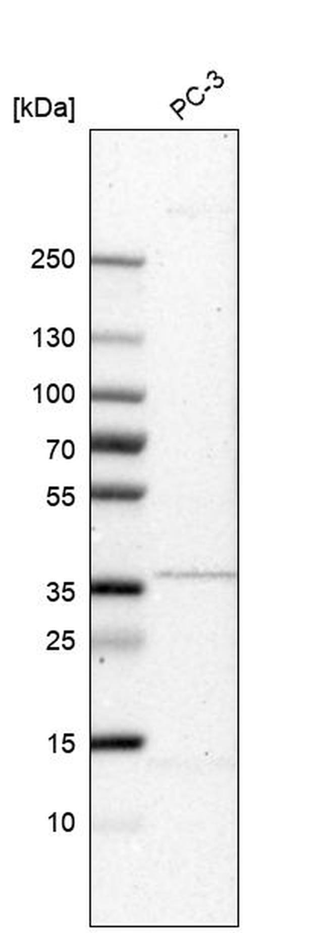 C3orf31 Antibody in Western Blot (WB)