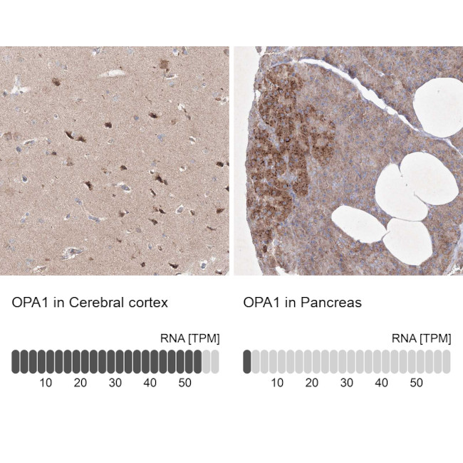 OPA1 Antibody in Immunohistochemistry (IHC)