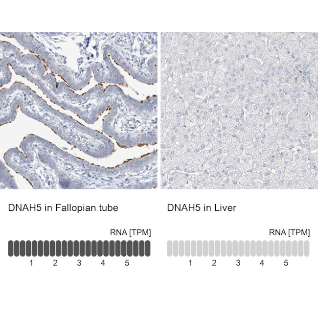 DNAH5 Antibody in Immunohistochemistry (IHC)