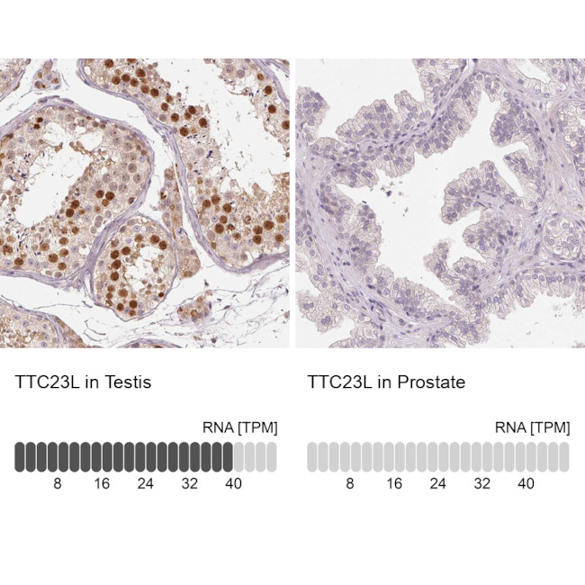 TTC23L Antibody in Immunohistochemistry (IHC)
