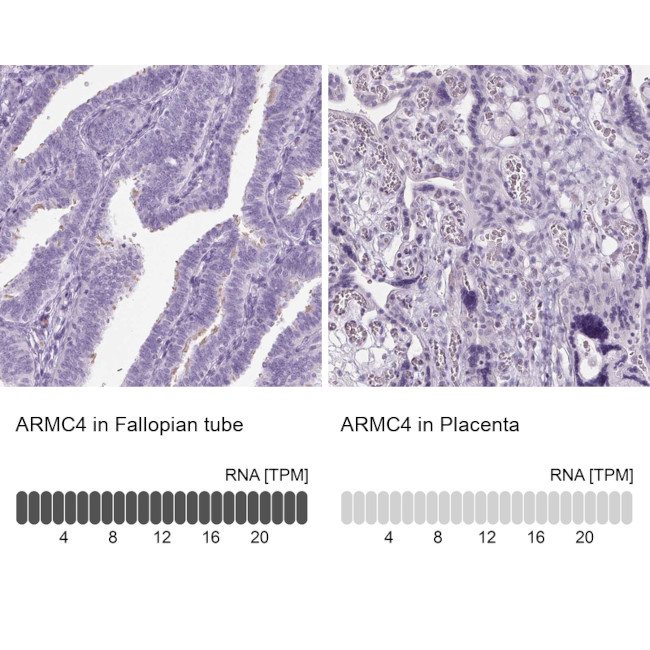 ARMC4 Antibody in Immunohistochemistry (IHC)