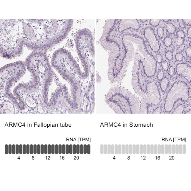ARMC4 Antibody