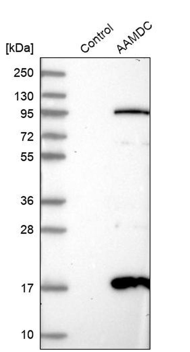AAMDC Antibody in Western Blot (WB)