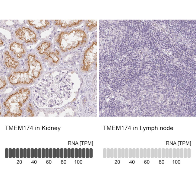 TMEM174 Antibody in Immunohistochemistry (IHC)