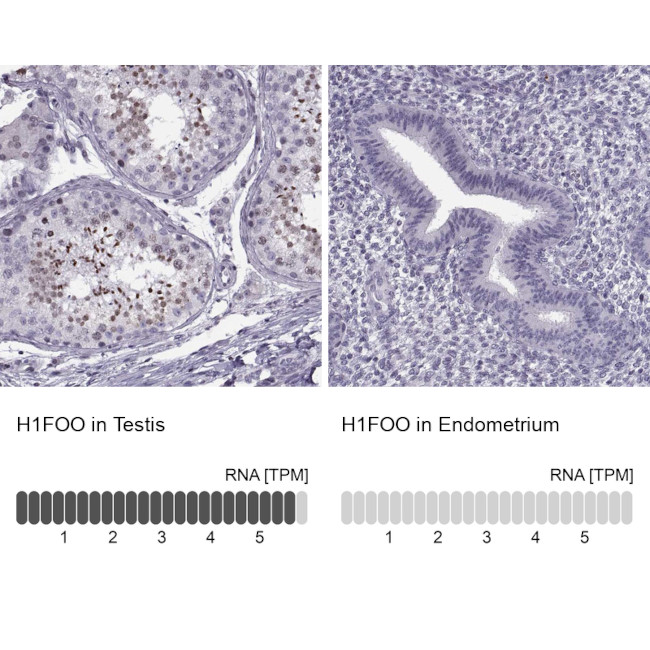 H1FOO Antibody in Immunohistochemistry (IHC)
