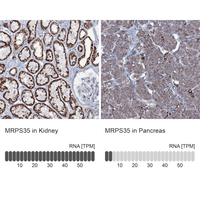 MRPS35 Antibody in Immunohistochemistry (IHC)
