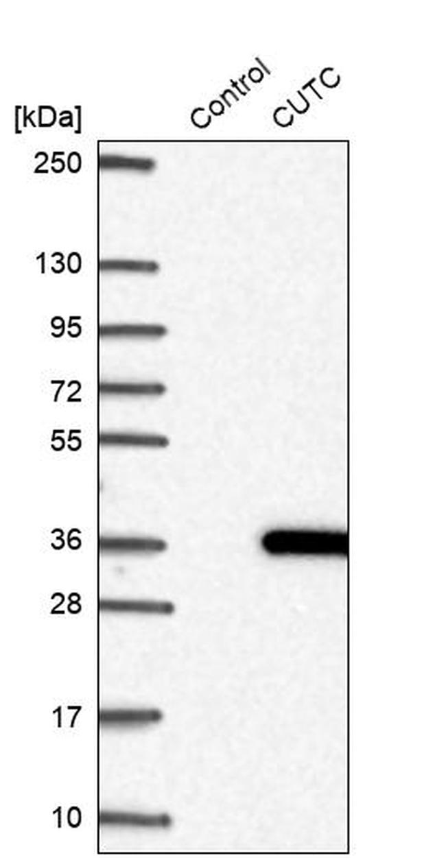 CUTC Antibody in Western Blot (WB)