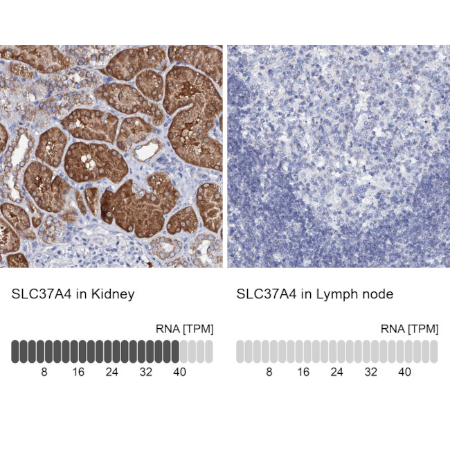 SLC37A4 Antibody in Immunohistochemistry (IHC)