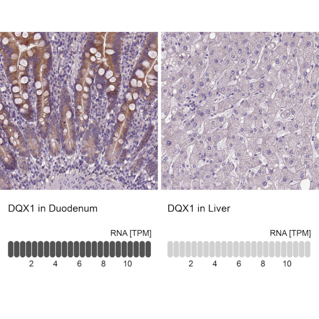 DQX1 Antibody in Immunohistochemistry (IHC)