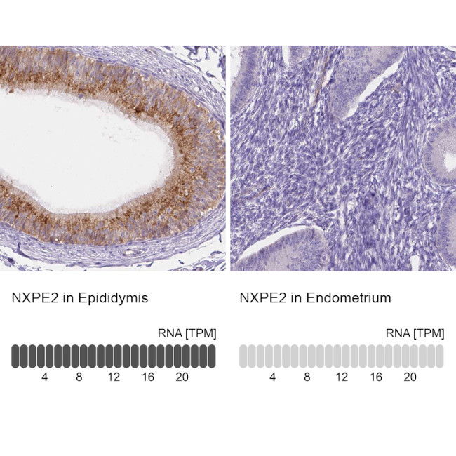 NXPE2 Antibody in Immunohistochemistry (IHC)
