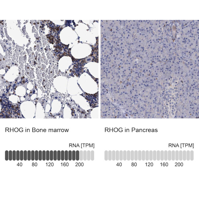 RhoG Antibody in Immunohistochemistry (IHC)