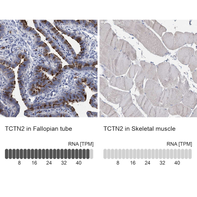TCTN2 Antibody in Immunohistochemistry (IHC)