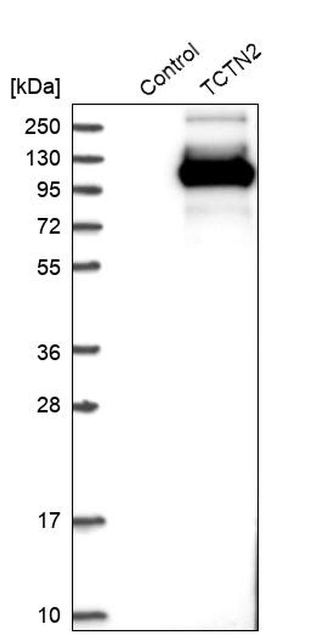TCTN2 Antibody in Western Blot (WB)