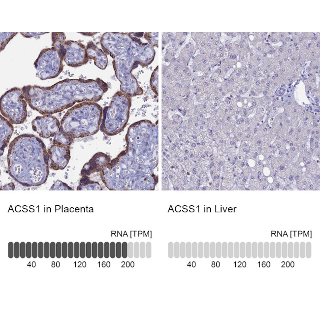 ACSS1 Antibody in Immunohistochemistry (IHC)