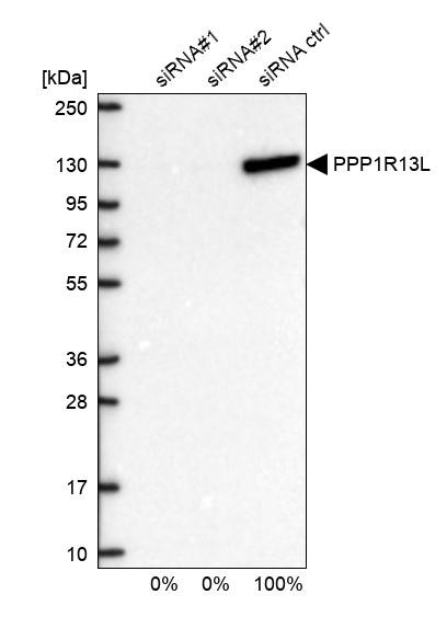 PPP1R13L Antibody
