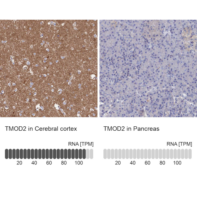 TMOD2 Antibody in Immunohistochemistry (IHC)