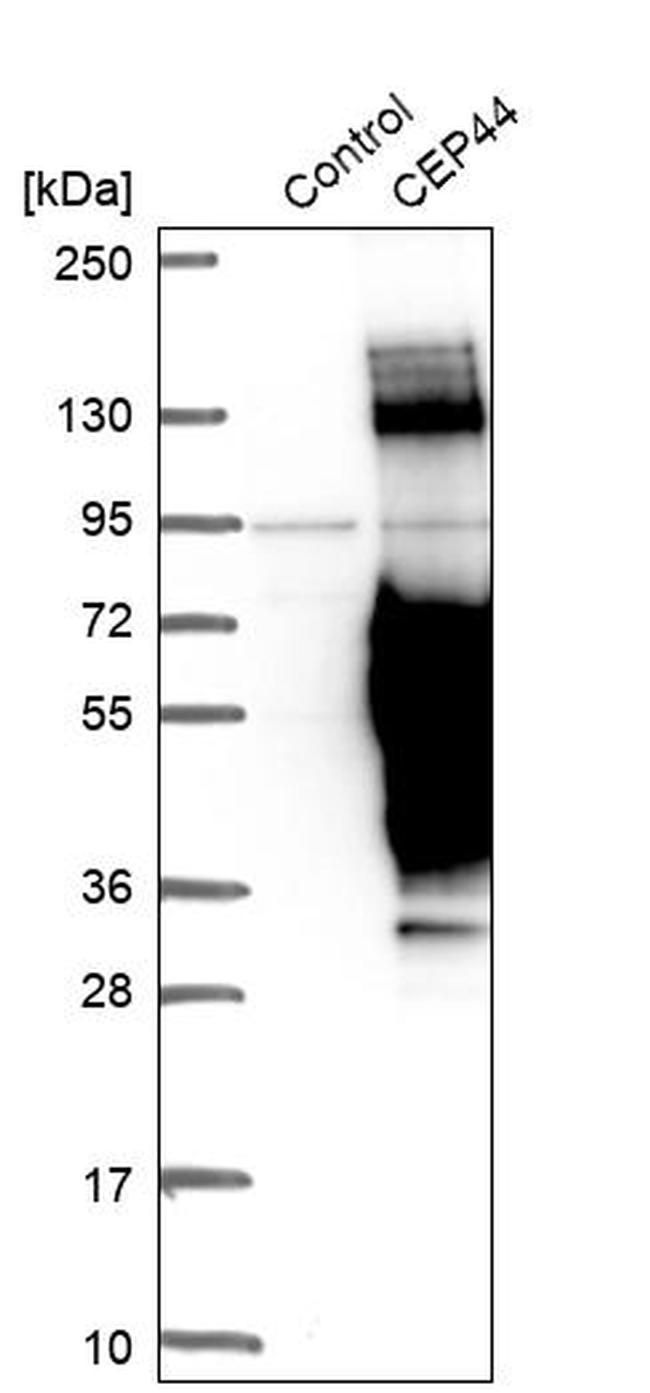 CEP44 Antibody in Western Blot (WB)