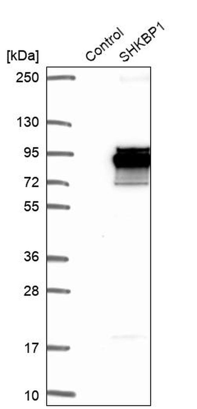SHKBP1 Antibody in Western Blot (WB)