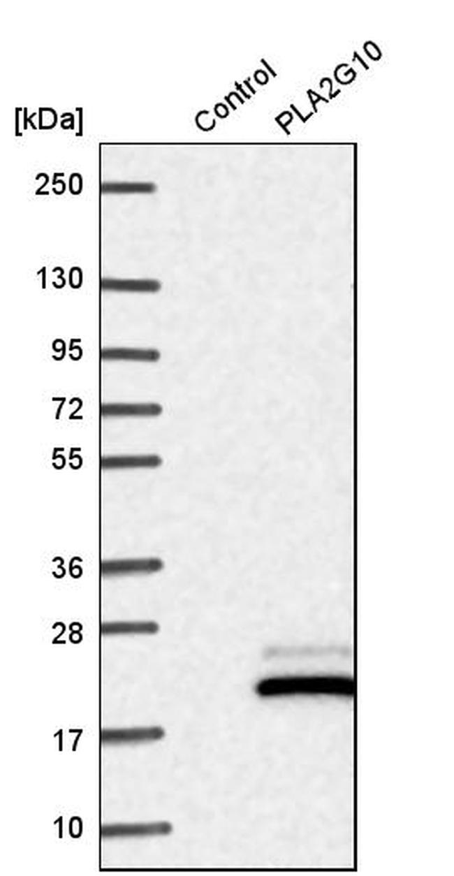 PLA2G10 Antibody in Western Blot (WB)
