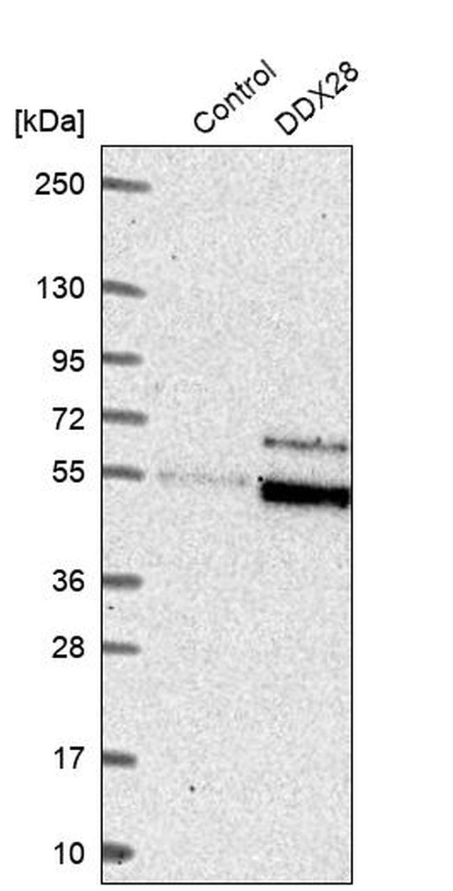 DDX28 Antibody in Western Blot (WB)