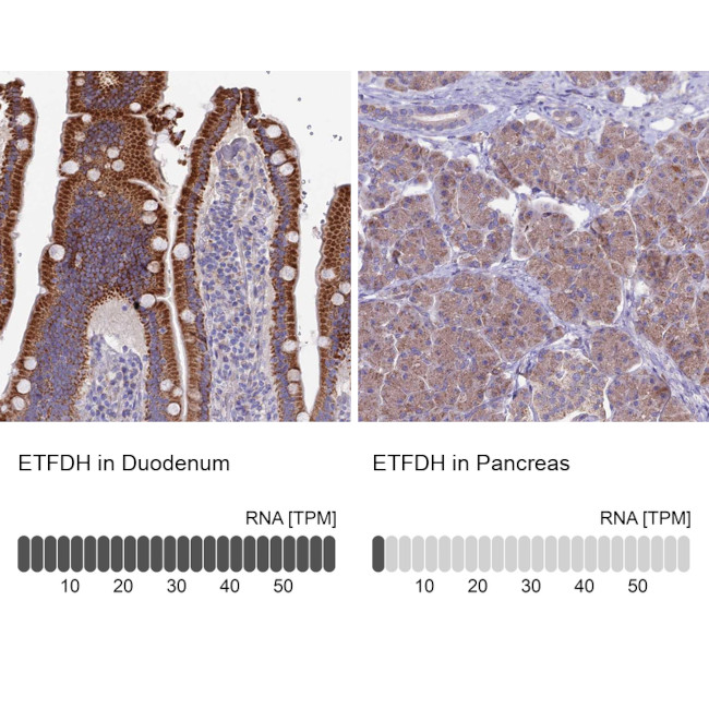 ETFDH Antibody in Immunohistochemistry (IHC)