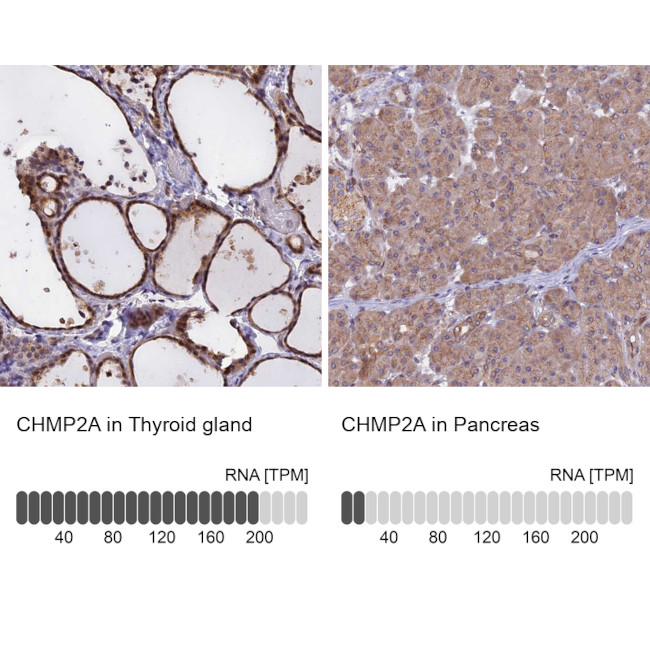 CHMP2A Antibody in Immunohistochemistry (IHC)