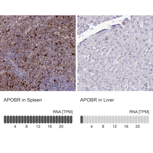 APOB48R Antibody in Immunohistochemistry (IHC)