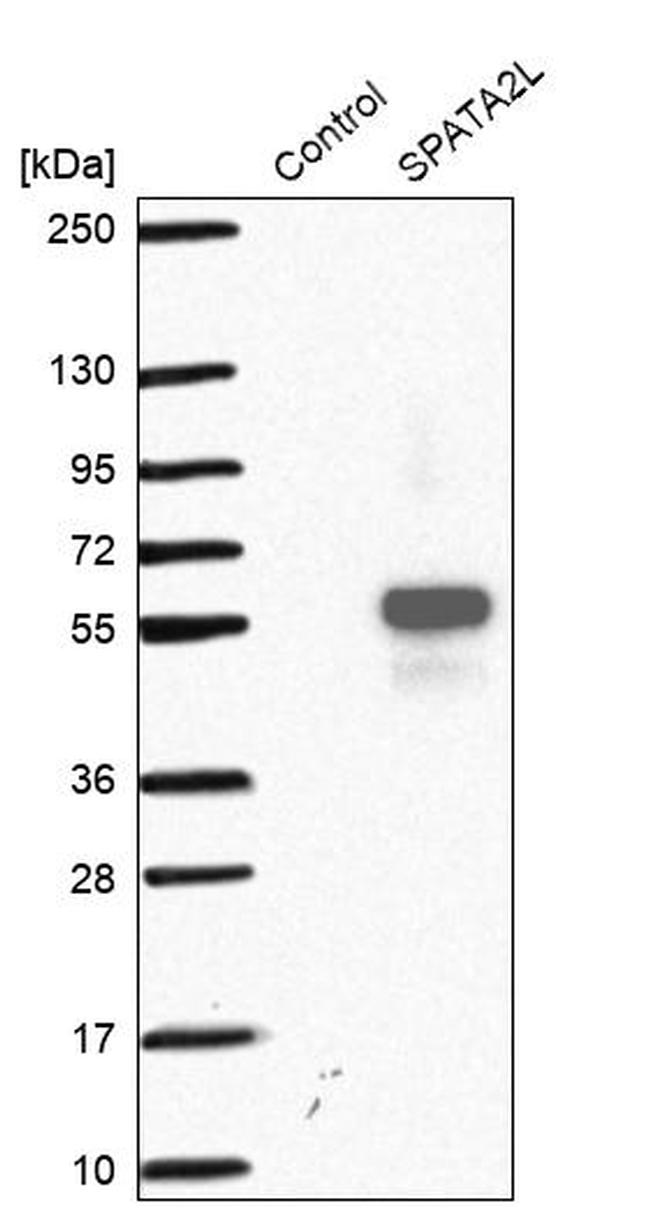 SPATA2L Antibody in Western Blot (WB)