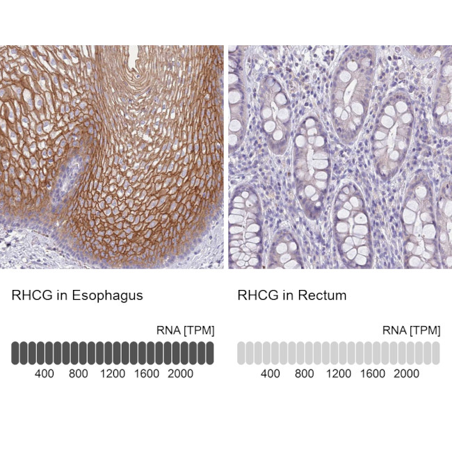 RHCG Antibody in Immunohistochemistry (IHC)