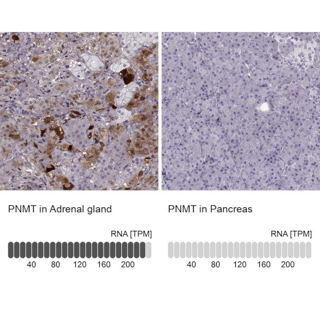 PNMT Antibody