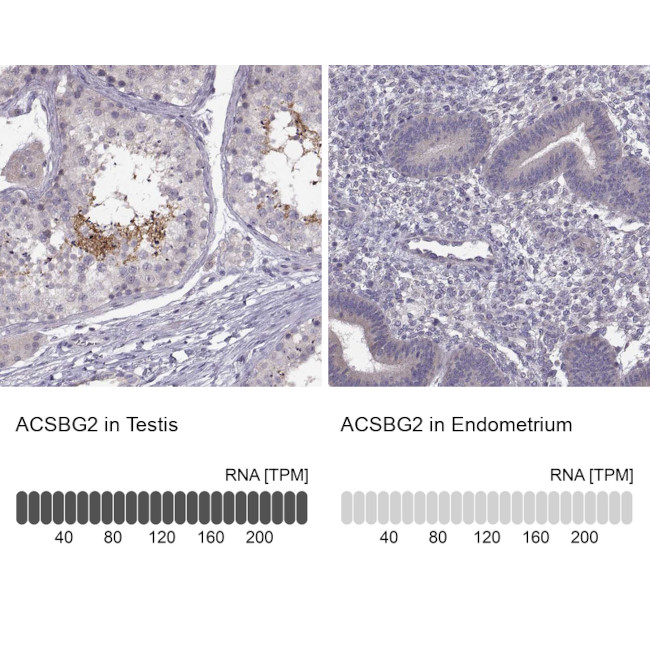 ACSBG2 Antibody in Immunohistochemistry (IHC)
