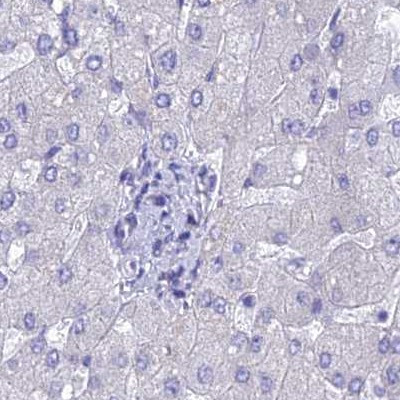 LZTFL1 Antibody in Immunohistochemistry (IHC)