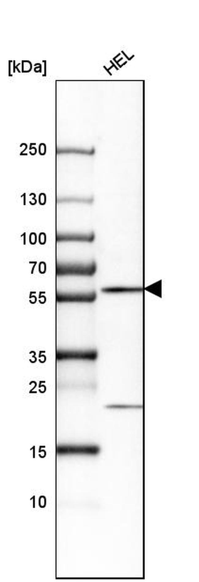 CCDC19 Antibody in Western Blot (WB)