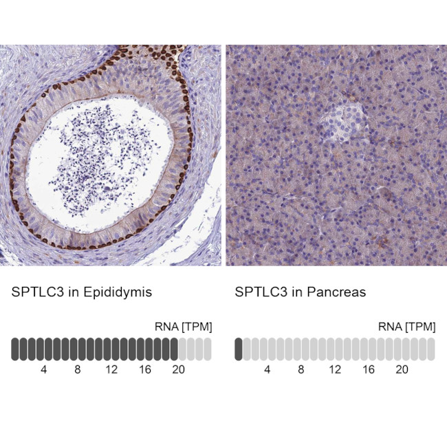 SPTLC3 Antibody in Immunohistochemistry (IHC)