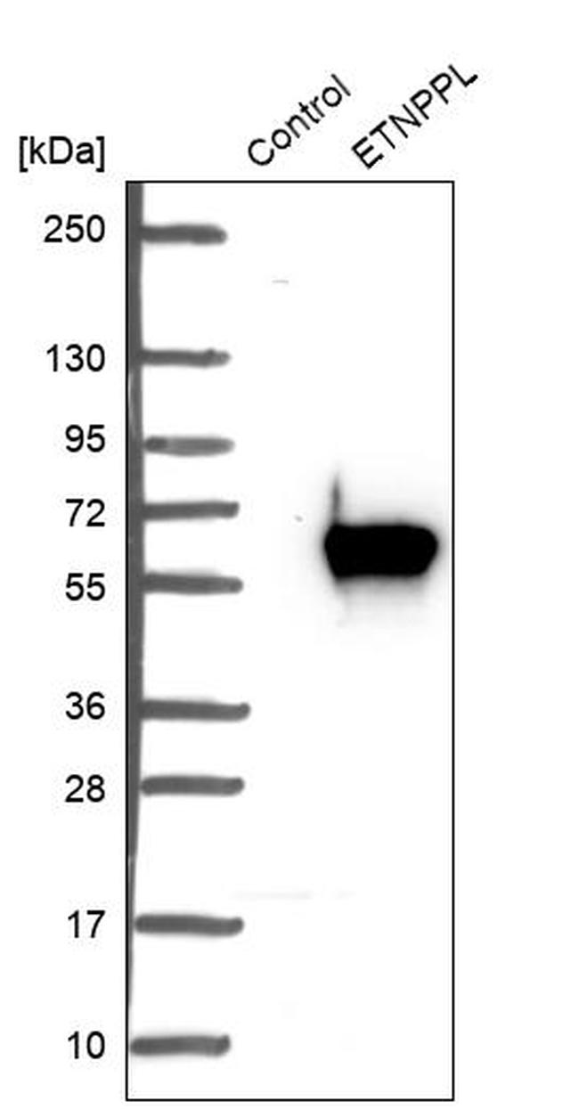 ETNPPL Isoform 1 Antibody in Western Blot (WB)