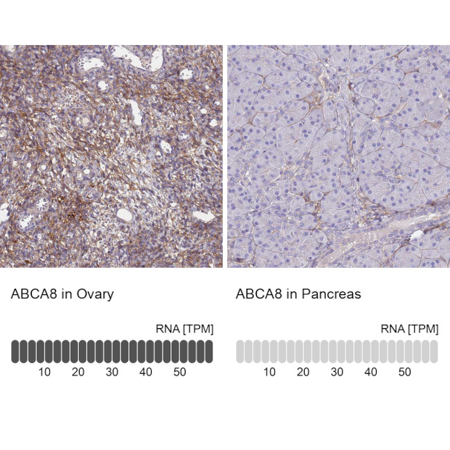 ABCA8 Antibody in Immunohistochemistry (IHC)