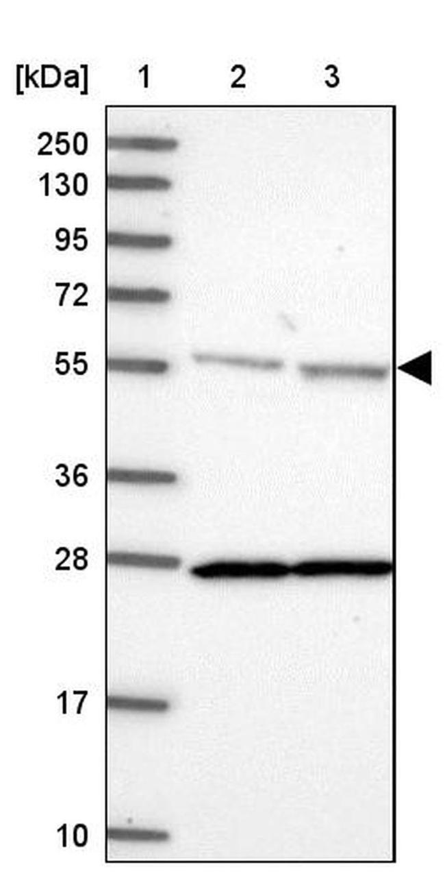 DDX19A Antibody in Western Blot (WB)